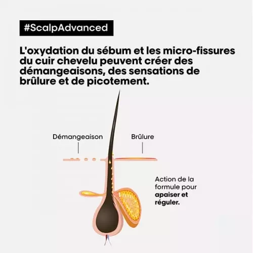 SHAMPOING DERMO-RÉGULATEUR APAISANT Scalp Advanced 